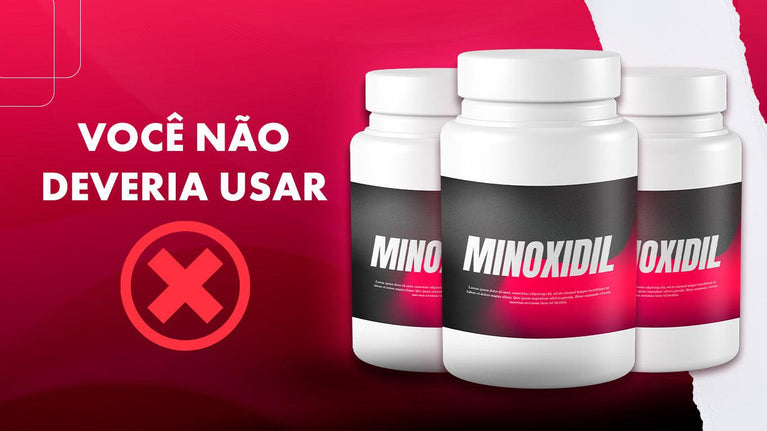 Devo usar o Minoxidil para calvície? Entenda o que é e como funciona o medicamento