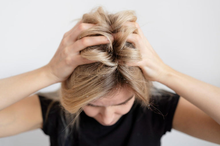 Queda de cabelo e calvície: diferenças e como tratar