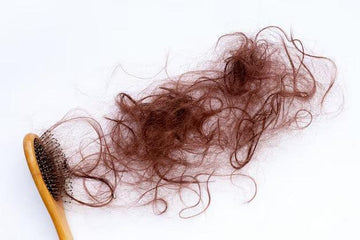 Conheça 5 principais tipos de alopecia