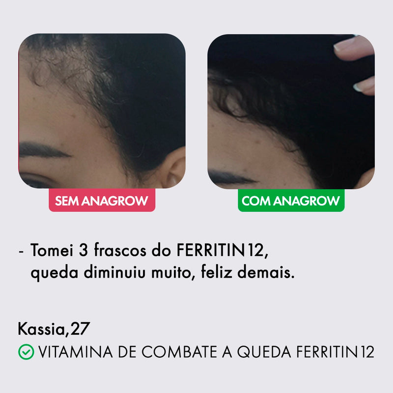 Slide Ferritin 1