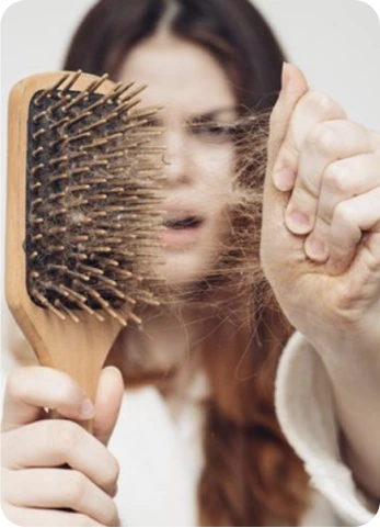 Queda de cabelo acima do normal: